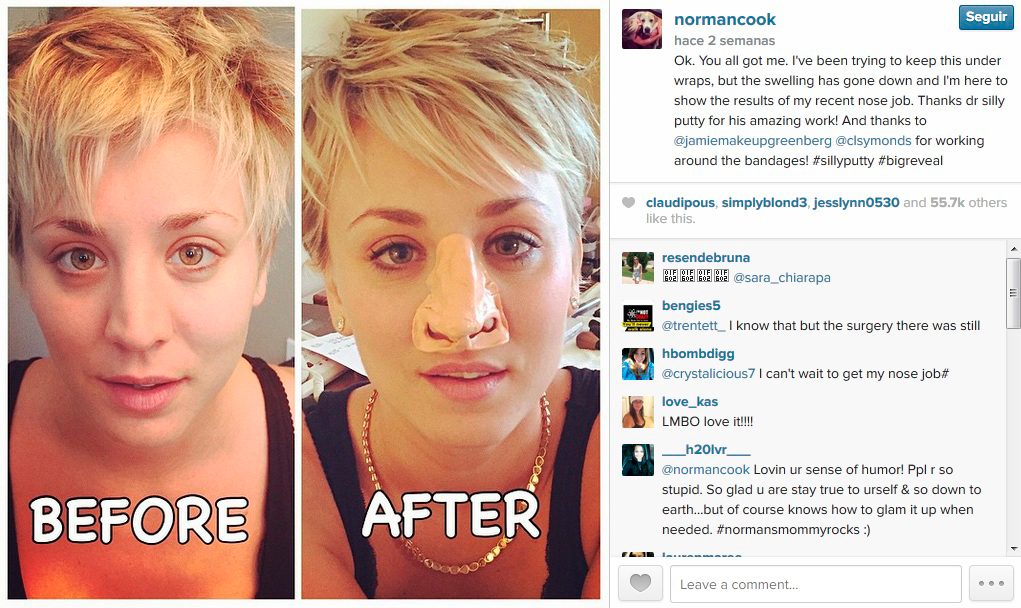 Foto subida por la actriz a Instagram bromeando sobre su supuesta rinoplastia